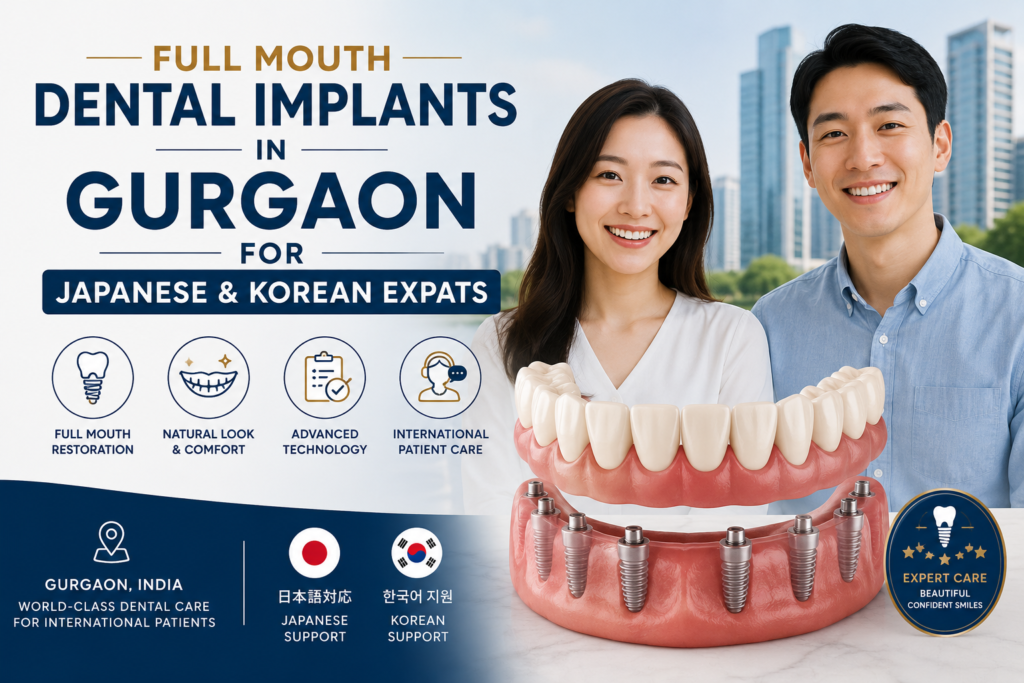 Full-Mouth-Dental-Implants-in-Gurgaon-for-Japanese-and-Korean-Expats